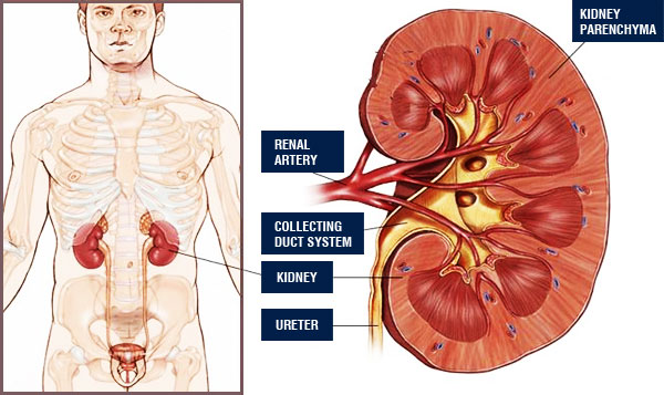 Kidney Cancer