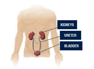 Robotic Pyeloplasty